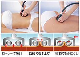 スーパーセルライト